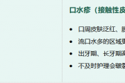 宝宝皮肤总出问题？这几种“痒”你真的了解吗？